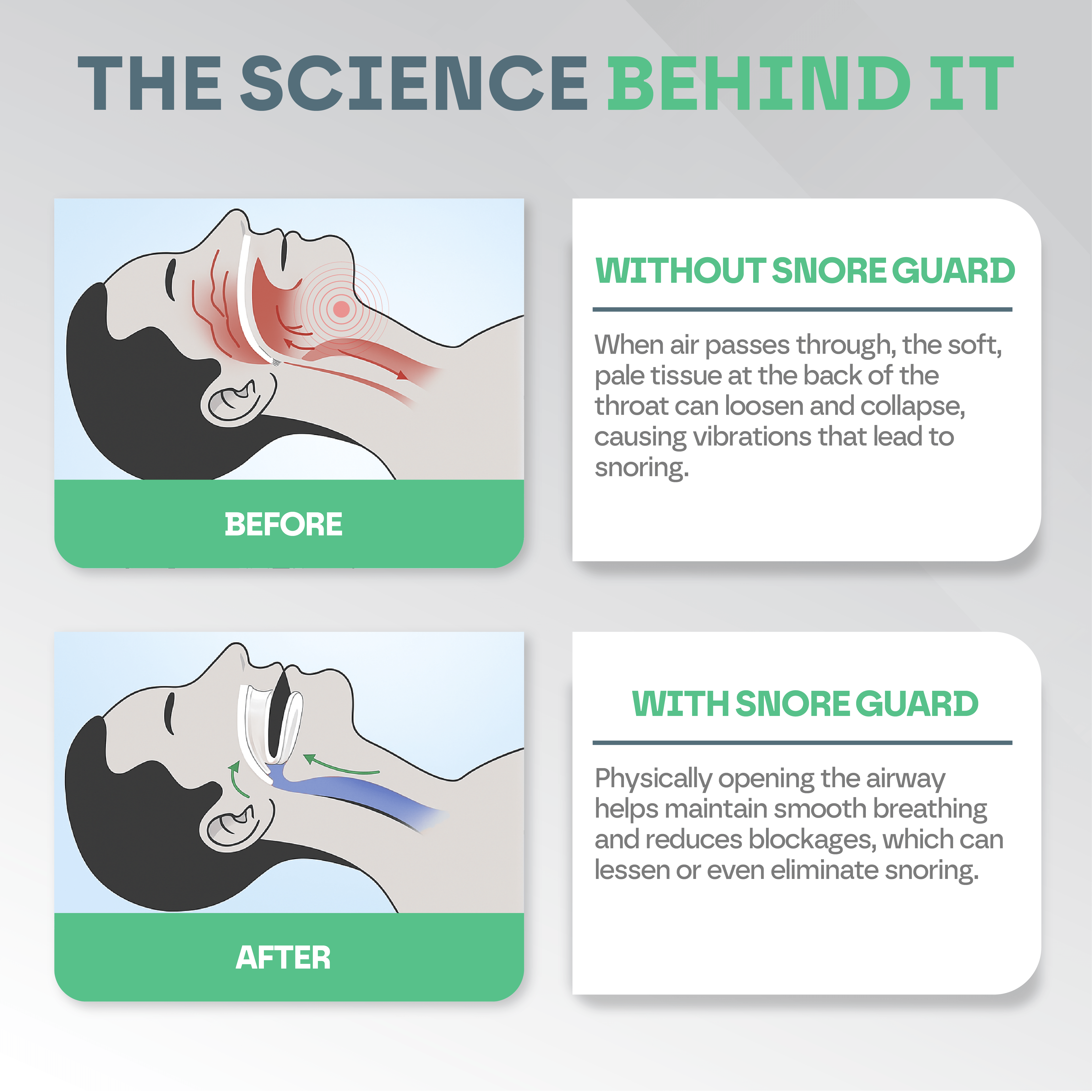 Anti Snore Mouth Guard Pro Snooze Therapy